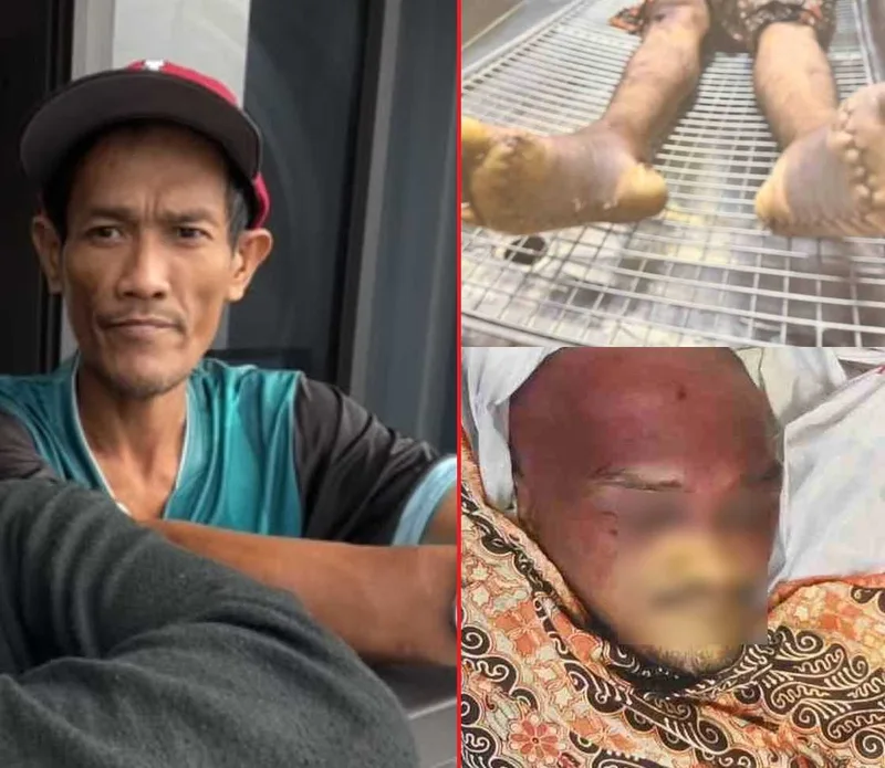 拘置所死亡、弁護士ら独立捜査を要求 写真「恐ろしい」